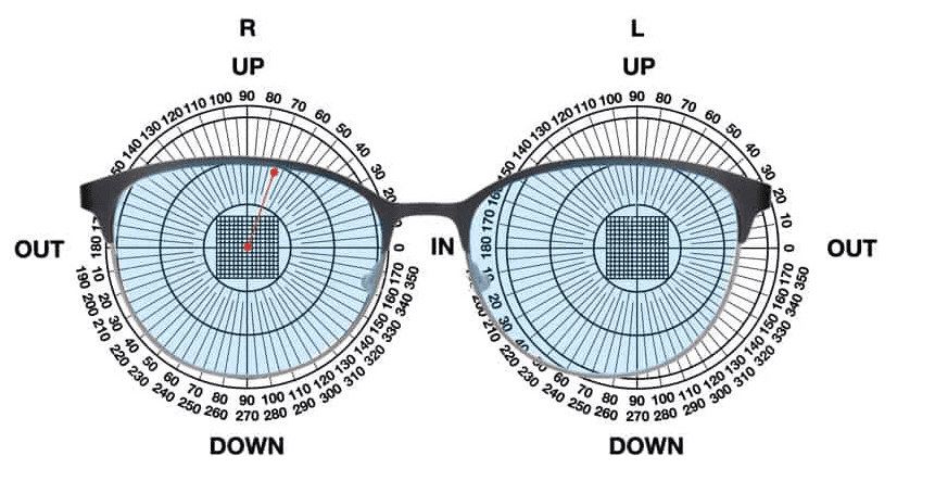 Hoe Fresnel prisma folie op glas bevestigen - MediSense 